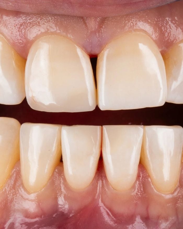 After: smooth, even biting edges