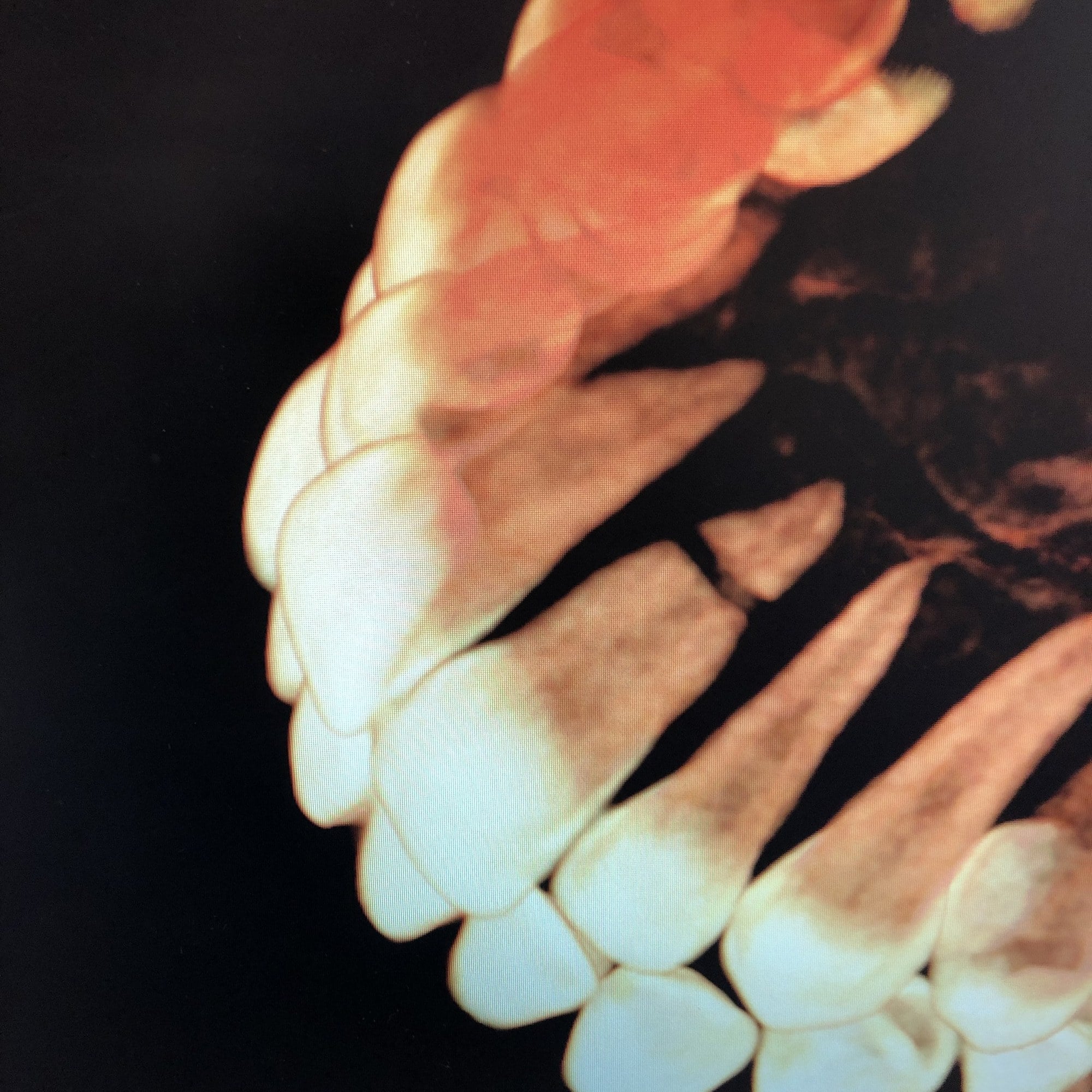 A 3D CBCT image of a row of teeth and their roots