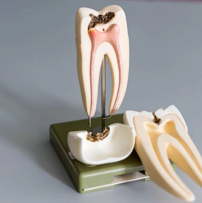 A cutaway model of a molar showing the root canals