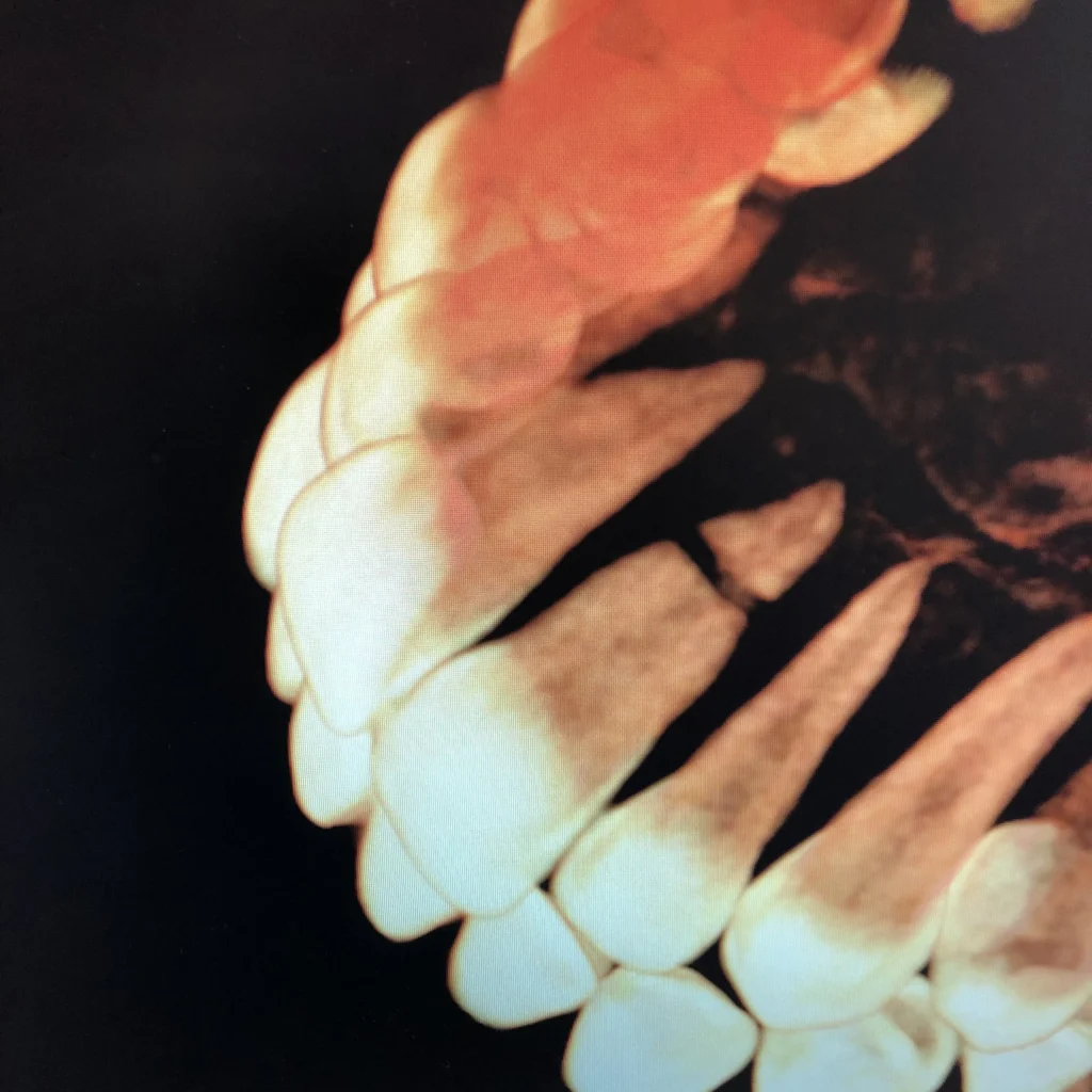 3D CBCT scan rendering of teeth and roots